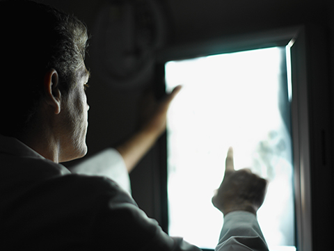 Holy Cross Health Lung Nodule Review Program